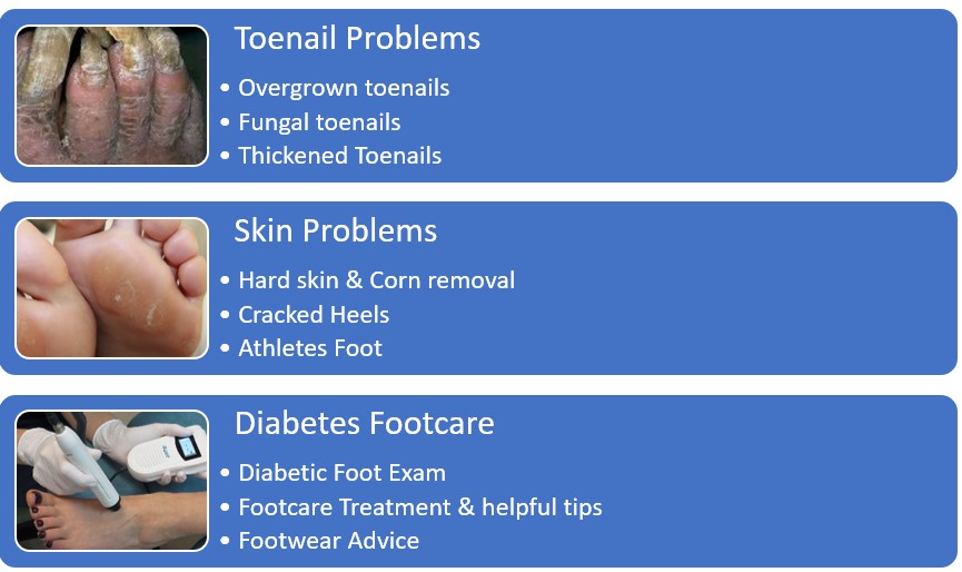Local Mobile Podiatrist(Chiropodist) Home Visits in Airdrie and Coatbridge.